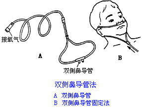 ◆肺病患者如何家庭氧療？